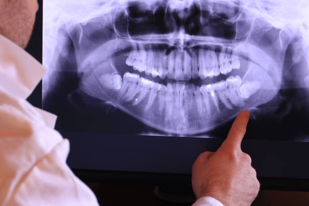 Best Emergency Treatment for Oral Infections in Somerton, AZ